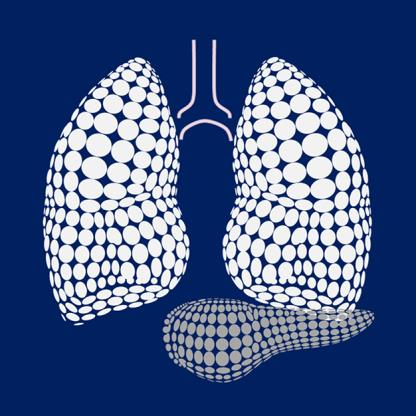 Prevention of Lung Injury asociated with Acute Necrotizing Pancreatitis