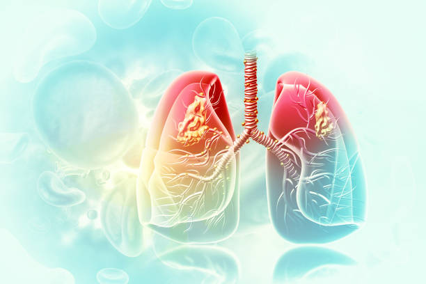 Antibody for Preventiang/Treating Secondary Respiratory Infections