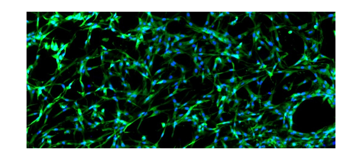 3D Bioactive Hyaluronic Acid Scaffold for Scalable Cell Manufacturing